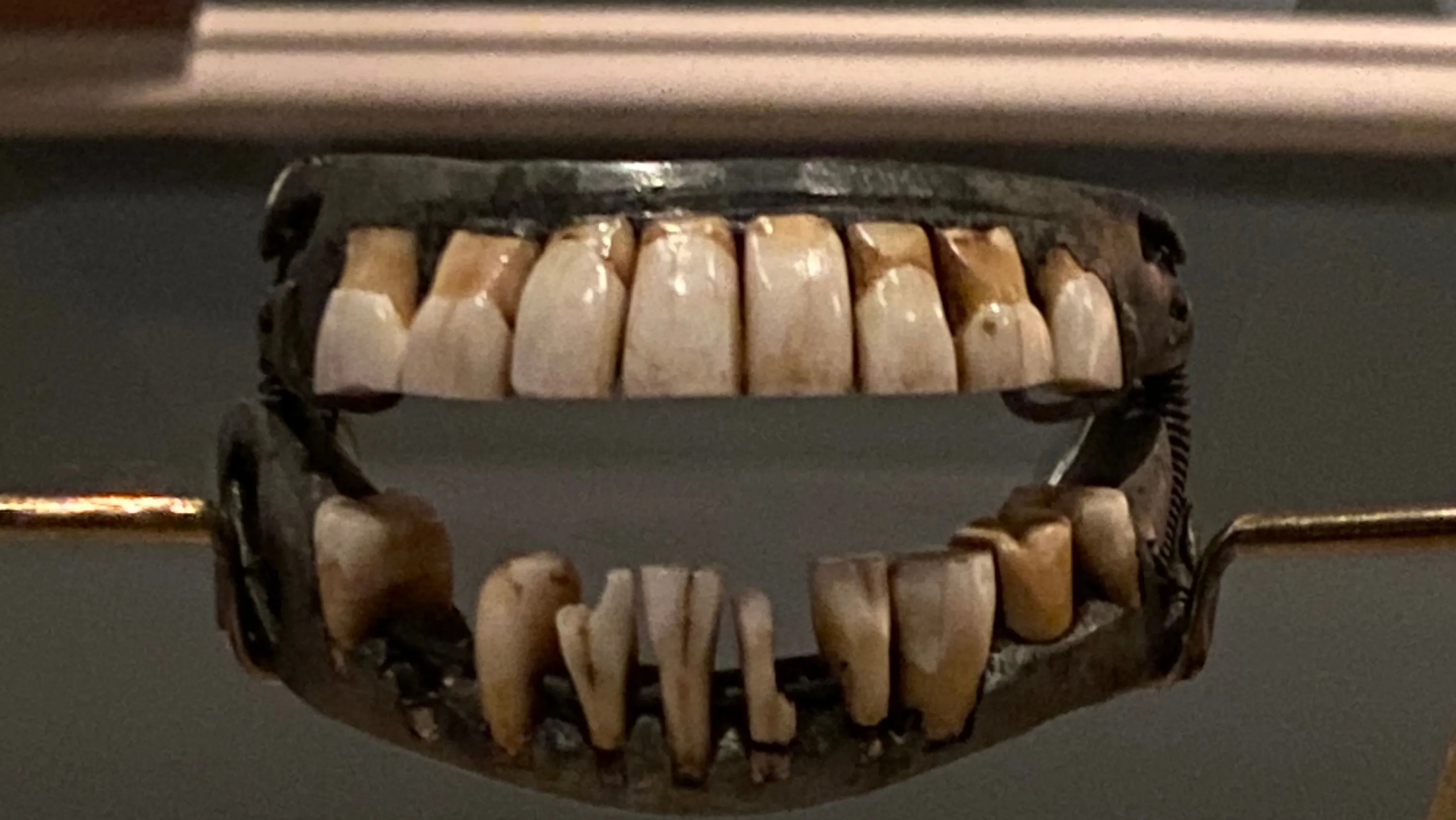The alleged Washington dentures